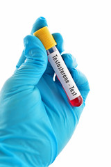 Obraz premium Blood sample for testosterone hormone test