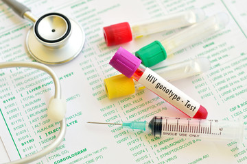 Fototapeta premium Test tube with blood sample for HIV genotype test 