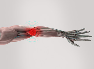 Obraz na płótnie Canvas Anatomy model showing elbow pain. On plain studio background.