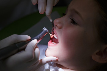 Girl getting her teeth polished