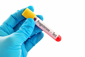 Obraz premium Progesterone hormone test 