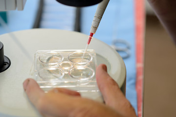 A vet picks up calf embryos for implantation into surrogate cows in an artificial breeding program