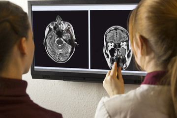 Doctor and patient looking at MRI image
