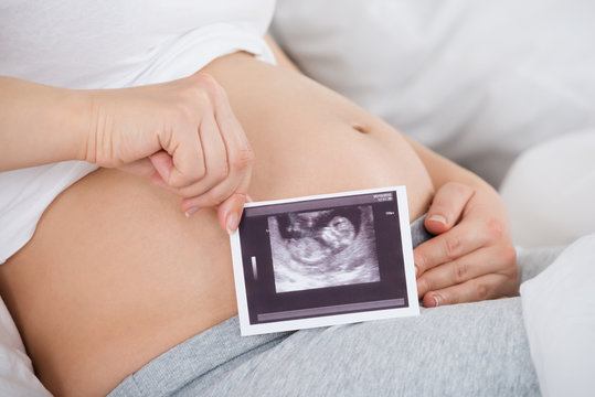 Pregnant Woman With Ultrasound Photo