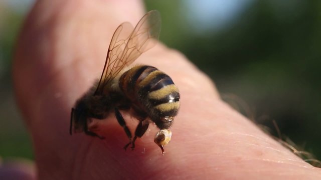 Bee stings a man.
Abandoned bee sting in the human body makes movements, releasing a poison vial.