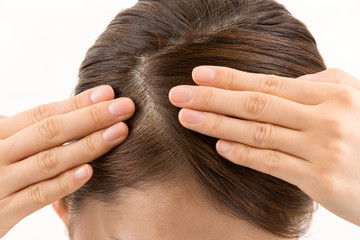 Obraz premium 頭皮・若い女性