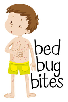 Boy having bed bug bites