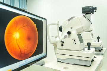 fundus camera use for  examination eye  in hospital