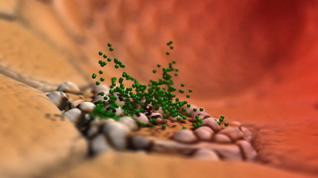 Ill cell and green medicine - 3d animation, HD 1080p