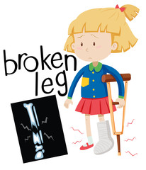 Fototapeta na wymiar Girl with broken leg and x-ray film