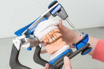Zahnimplantat wird im dentallabor im artikulator geprüft