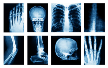 Collage of many X-rays