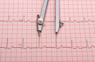 Electrocardiogram graph report and calipers