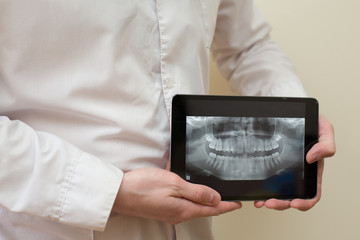 x ray tablet