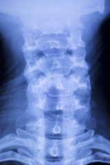 Skull neck spine shoulders xray scan