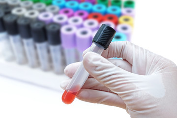 black plastic stopper (selected focus) on blood collection tube,