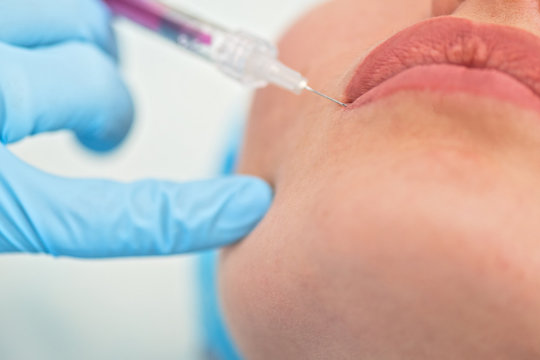 woman gets injection in her lips