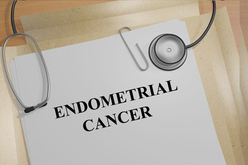 Endometrial Cancer concept - obrazy, fototapety, plakaty