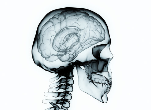 X-ray brain and skeleton isolated on white background