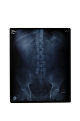 x-ray, skeleton, spine