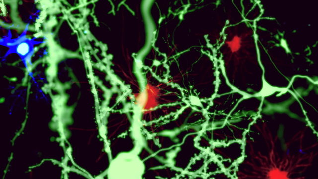 Gehirnzellen.
Grün: Neuronen, rot: Astrozyten, blau: Mikroglia-Zellen