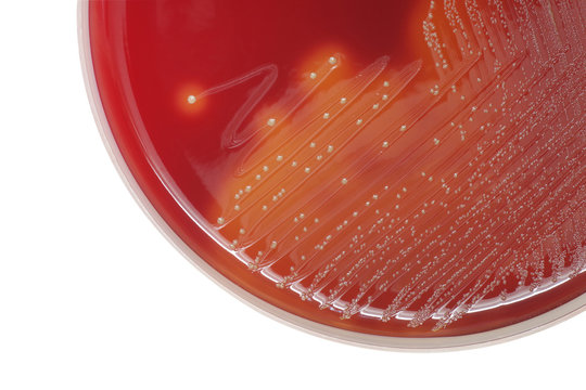 Streptococcus bacterial colonies with beta hemolytic on blood agar plate on white background, close-up.
