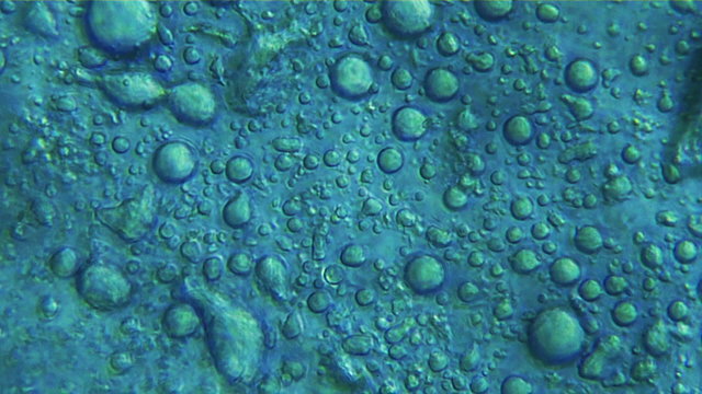 Yeast Fungi Spheres Under Microscope