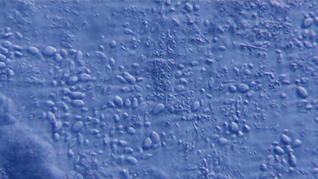 Bacteria Colony Blue Tint Seen on Microscope 400x