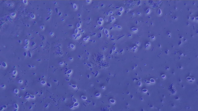 Bacteria Colony 400x Magnification