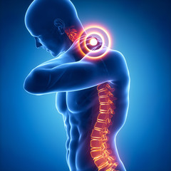 Spine injury pain in sacral and cervical region concept