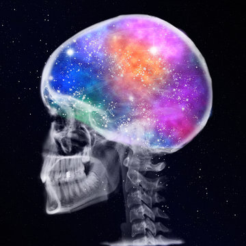 rtg of human skull with galaxy