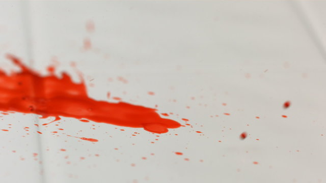 Blood dripping on floor