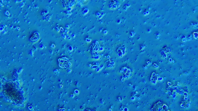 Dental Plaque Bacteria in Phase Microscope 600x Blue Filter Microscope View