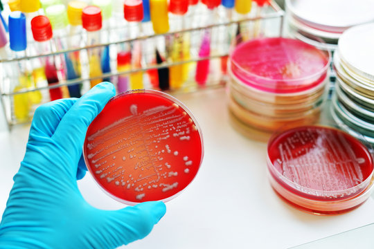 Colonies of bacteria in culture medium plate
