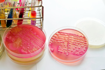 Colonies of bacteria in culture medium plate
