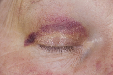 Fototapeta premium blaues Auge eines Mannes