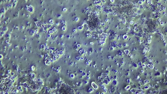 Bacteria Sample From flesh decomposition 600x Microscope view.