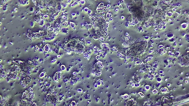 Dental Plaque from human sample seen in phase contrast microscope 800x