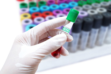 green plastic stopper (selected focus) on lithium heparin blood