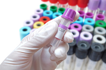 purple plastic stopper (selected focus) on Tris-EDTA blood tube