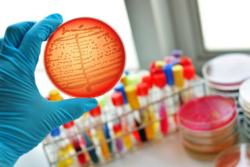Colonies of bacteria in culture medium plate
