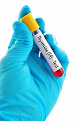 Fototapeta premium Blood sample for thyroxine (T4) hormone test