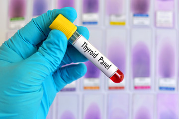 Blood sample for thyroid panel test
