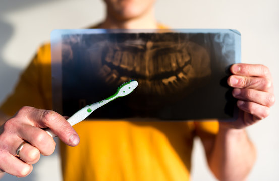 Picture of a tooth jaw and toothbrush.