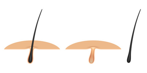 hair follicle .cross section.