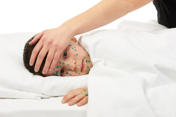 sick child has the virus on skin