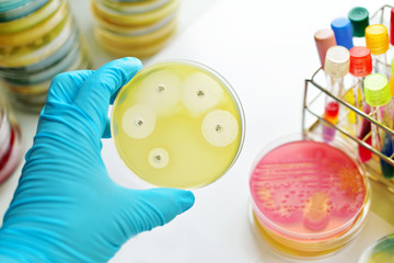 Antimicrobial susceptibility testing in petri dish
