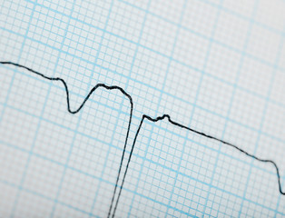 Abstract graph with a curve