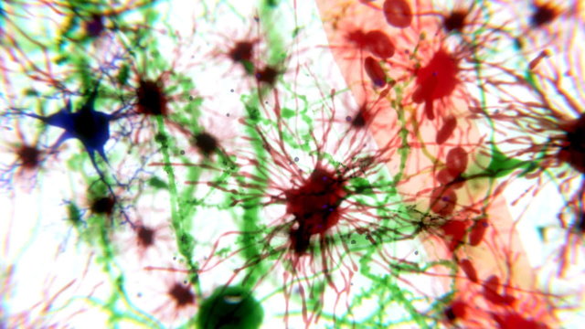 Zellen des Gehirns, Astrozyten.
Vershiedene Zelltypen des Gehirns, fokussiert auf die Astrozyten (rot). Neuronen grün), Microglia-Zellen (blau)