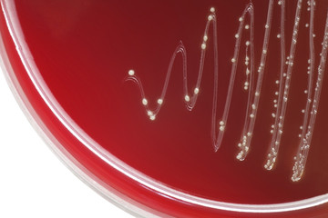 Streptococcus bacterial colonies with alpha hemolytic on blood a